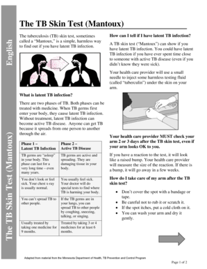 The TB Skin Test (Mantoux) . This fact sheet provides information about the skin test that is done to test for tuberculosis (TB). - public health oregon