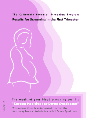 California Prenatal Screening Program Results