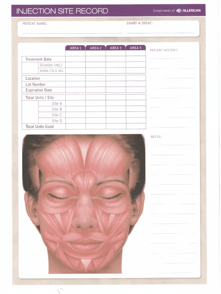 botox face diagram pdf