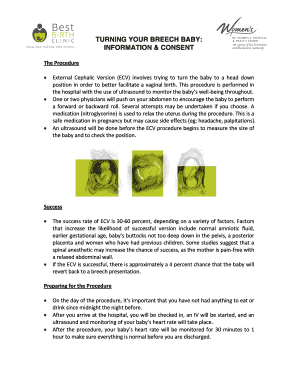 External Cephalic Version Consent Form
