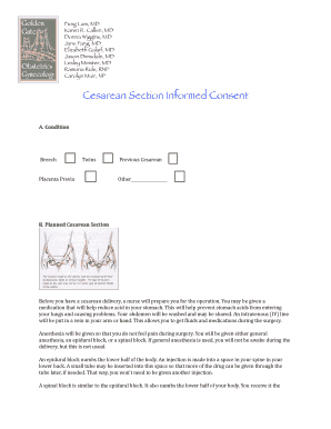 Cesarean Section Informed Consent