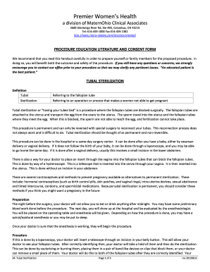Tubal Sterilization Consent Form