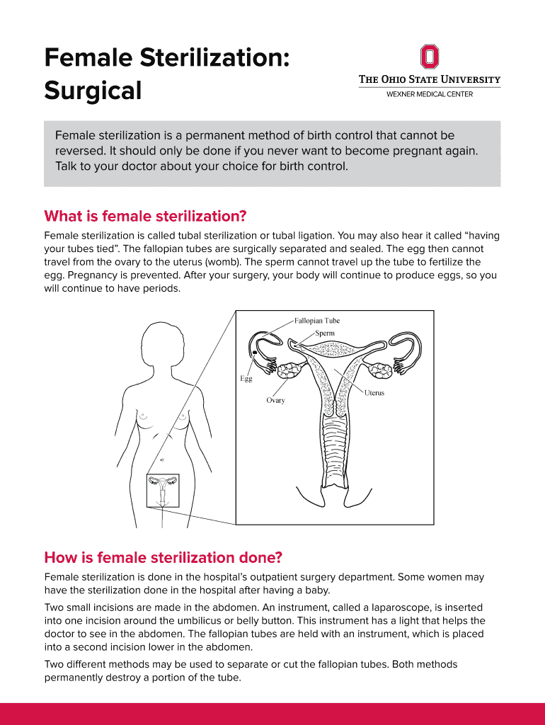 Fillable Online Female Sterilization: Fax Email Print - pdfFiller