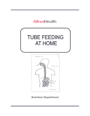 Tube Feeding Guide