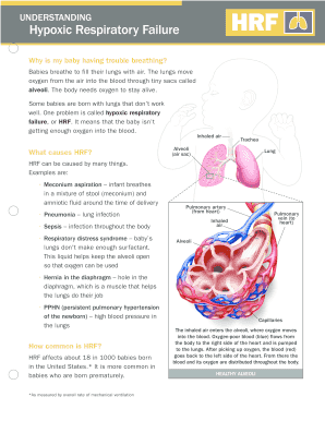 Hypoxic Respiratory Failure Guide