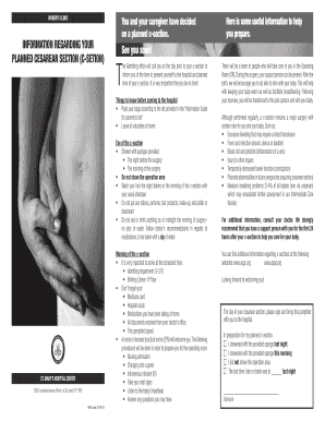 Planned Cesarean Section Information