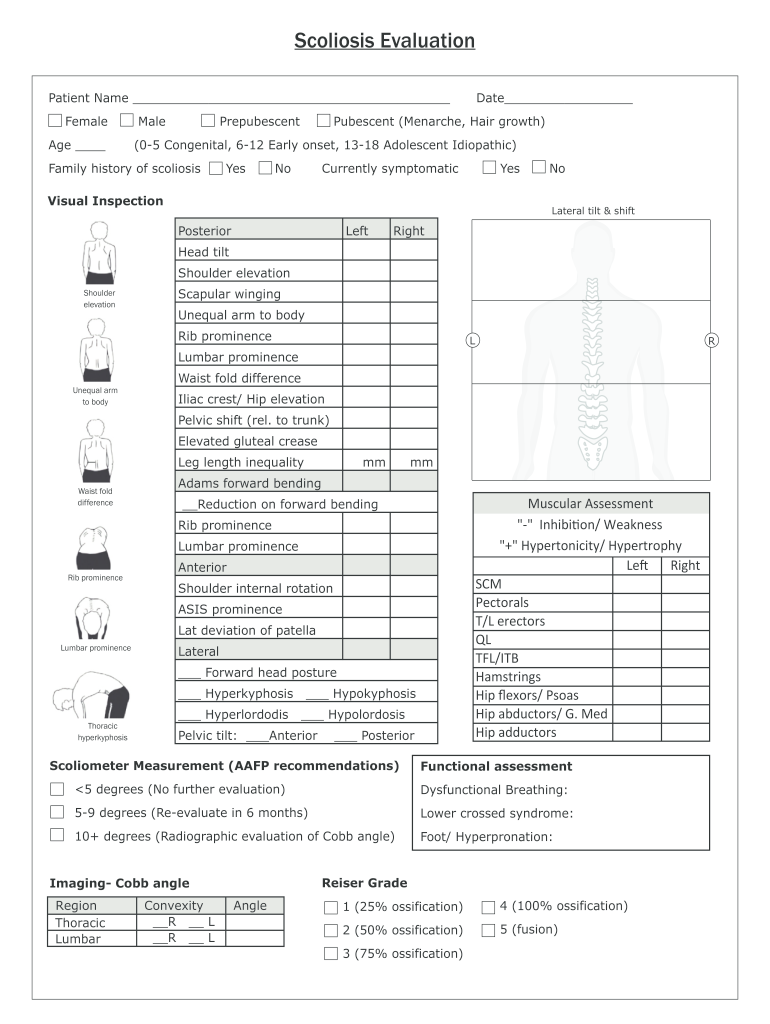 Fillable Online scoliosis exam form Fax Email Print pdfFiller