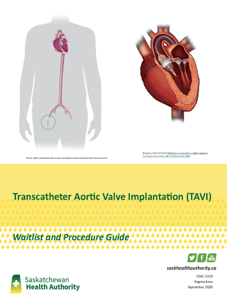 Fillable Online Valveinvalve what does it mean for lifetime