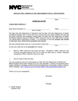 Mantoux Tuberculin Test Requirement Notice