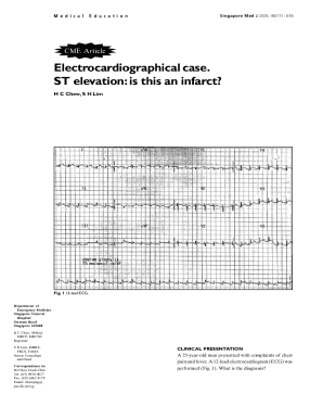 Electrocardiographical case. ST elevation: is this an infarct ...