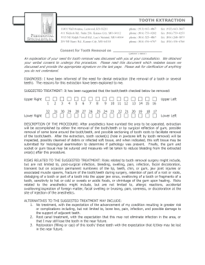 Tooth Extraction Consent Form