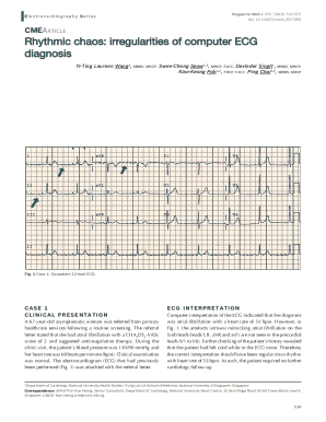 Rhythmic chaos: irregularities of computer ECG diagnosis